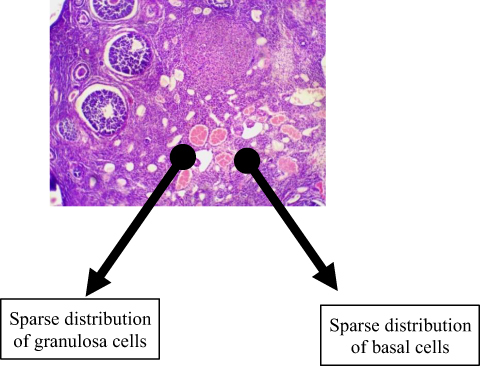 Figure 6 This figure shows the group that received a combination of efavirenz, tenofovir, and lamivudine as a fixed-dose combination had granulosa and basal cells sparsely distributed. The follicles were markedly reduced across various stages of development.