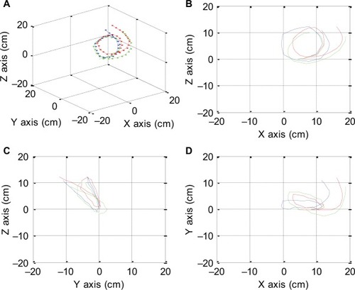 Figure 25 Multiple views of the predicted reverse splenic flexure test are shown. Isometric view (A), right-side view (B), left-side view (C), top view with right side as X axis (D).