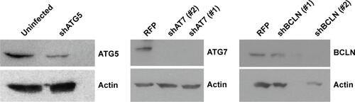 Figure S2 Expression of ATG7, ATG5, and BCLN in shRNA knockdown cells.Notes: U937 cells with shRNA expression as indicated were prepared. Cell lysates from shRNA expressing U937 cells were collected and subjected to Western blot analysis for determining the expression of ATG7, ATG5, BCLN, and actin (loading control). Two shATG7 or shBECN clones (#1 or #2) were used.Abbreviations: BCLN, Beclin-1; shRNA, short hairpin RNA.