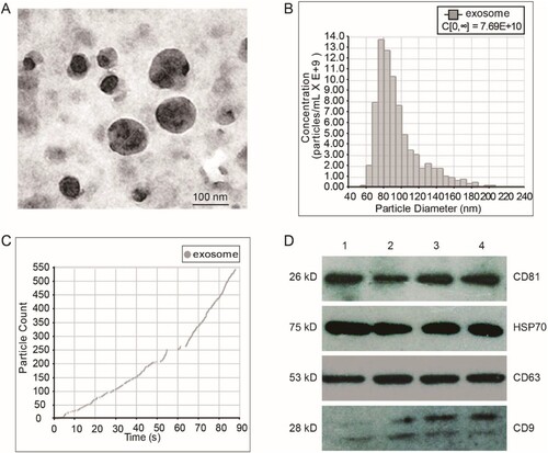 Figure 1. Characterization of fetal liver cell-derived exosomes (FLC-EXOs). Exosomes were isolated by ultracentrifugation combined with ultrafiltration. After isolation, FLC-EXOs were observed using TEM. The isolated vesicles had a cup-like shape (a). After ultracentrifugation, the pellets of FLC-EXOs were dissolved in 500 µL PBS, and then the distribution of particle diameter and concentration of FLC-EXOs were analyzed using the nanoparticle tracking analysis system of qNano (Izon, Christchurch, New Zealand) (b), and 550 particles were analyzed to make the data statistically representative (c). To further confirm the identity of FLC-EXOs, 5 µg of FLC-EXOs were loaded in each lane and probed with exosome-specific antibodies against CD81, HSP70, CD63, and CD9. Number 1–4 represents four samples of exosomes that isolated in parallel (d).