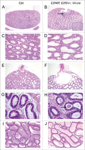 Figure 1. Mutation of E2f4 and E2f5 leads to seminiferous tubule and rete testis dilation and a failure of spermatozoa to reach the epididymis. (A) Sagittal sections of adult testis from control (Ctrl) and (B) E2f4f/f;E2f5+/−;Vil-cre littermates showing dilation of the seminiferous tubules and rete testis as well as spermatozoa within the rete testis (arrow), and inset image in the mutant. (C) Seminiferous tubules from control and (D) mutant testis showing tubule dilation. (E) Section through the rete testis of control and (F) mutant testis showing rete testis dilation. (G) The efferent ducts of control and (H) mutant testis showing spermatozoa within the efferent ducts of the mutant (arrow). (I) The epididymis of control adults contains spermatozoa in contrast with the mutants (J) where none are detected. All tissue sections were stained with hematoxylin and eosin. Scale bars in A and B, 250 μm; E and F, 200 μm; C, D, I and J, 100 μm; G and H, 20 μm.