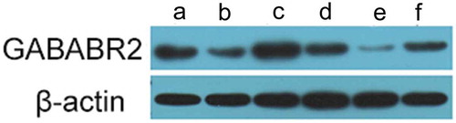 Figure 7. GABABR2 protein expression was up-regulated in 17A shRNA-transfected cells and down-regulated in pcDNA-17A transfected cells. (a) Normal culture SH-SY5Y cells; (b) SH-SY5Y cells cultured with Aβ 1-42 as negative control 1 42; (c) SH-SY5Y cells transfected with 17A shRNA; (d) Scrambled control; (e) SH-SY5Y cells transfected with pcDNA-17A; (f). SH-SY5Y cells transfected with pcDNA-control.