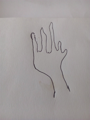 Figure 5. The hand and its fingers.