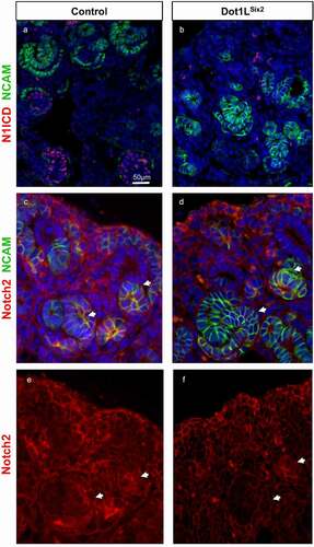 Figure 7. Notch2 is downregulated in nascent nephrons of Dot1LSix2 kidneys. Section immunofluorescence for Notch 1 intracellular domain, Notch2, and NCAM (a marker of induced nephron progenitors and nascent nephrons). Arrows denote nascent nephrons. N = 3–4/group