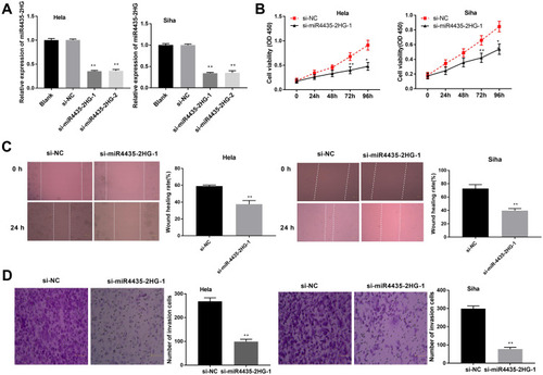 Figure 2 LncRNA MIR4435-2HG knockdown inhibits the proliferation, migration and invasion of CC cells in vitro. (A) The expression of MIR4435-2HG after transfection of si-miR4435-2HG-1/-2 into CC cells was detected by qRT-PCR. **P < 0.01 vs the si-NC group. (B) The viability (OD450) of CC cells was measured by MTT assay. (C) The wound healing rate of CC cells was measured by wound healing assay. (D) The number of invasion cells was measured by transwell invasion assay. **P < 0.01 vs the si-NC group.