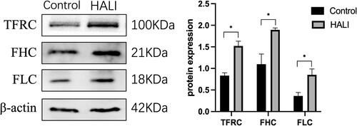 Figure 5 Western blotting analyzed the expression of TFRC, FHC, FLC, which is involved in iron transport storage. *P < 0.05 vs the control group. Data were shown as mean ± SD, n = 3.