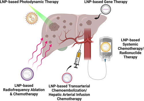 Figure 1 Schematic overview of current LNP-based tumor cell-targeting strategies in liver metastasis management (Created with BioRender.com).