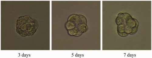 Figure 34. Folic acid treatment group for 3D tumour spheroid. Scale bar = 100 μm.
