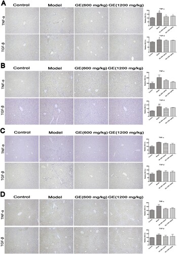 Figure 4. Cytokines expression in different models. Representative images (×100) of immunohistochemical staining for cytokines in liver tissue were shown. (A) acute liver injury model, (B) liver fibrosis model, (C) liver cirrhosis model, (D) the first stage in hepatocellular carcinoma. All values are expressed as mean ± S.E.M. (n = 7). #p < .05, vs. control group; *p < .05, vs. model group.