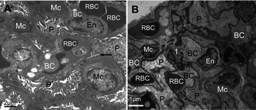 Figure 5 Ultrastructure of glomerulus after NiNPs administration: (A) control group showing well developed podocytes with their foot processes (arrow), endothelial and mesangial cells. Red blood cells in the blood capillaries are seen; (B) the NiNP-treated group showing degenerated podocytes and mesangial cells. The nuclei of mesangial cells (1) are seen fragmented.Abbreviations: P, podocytes; EN, endothelial cells; RBC, red blood cells; BC, blood capillary; Mc, mesangial cells; NiNPs, nickel nanoparticles.