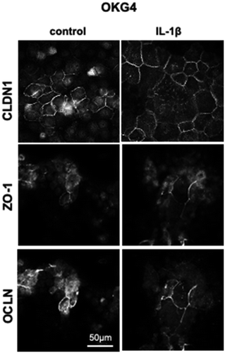 Figure A5. IL-1β increases the expression of occludin and enhances the formation of TJ strands in OKG4 cells. 1.2 × 104 OKG4 cells treated with IL-1β or left untreated for 24 h were fixed and stained for claudin-1, ZO-1 and occludin. Image processing was performed with ZEN and ImageJ. Scale bar, 50 µm.