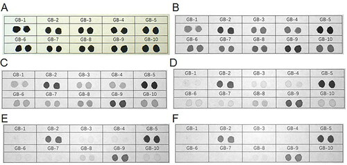 Figure 8. Changes in 10 types of black fountain pen ink on printing paper obtained under infrared (IR) illumination conditions using continuous interference band-pass filters. (A) Original diagram under visible light. (B–F) IR absorption diagram at 645, 695, 715, 850, and 1 000 nm.