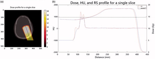 Figure 4. The dose profile is evaluated on a central line along the slices of the dose volume (a). For the same slice it the dose distribution and HU values for both pCT and CT along the beam line are plotted (b).