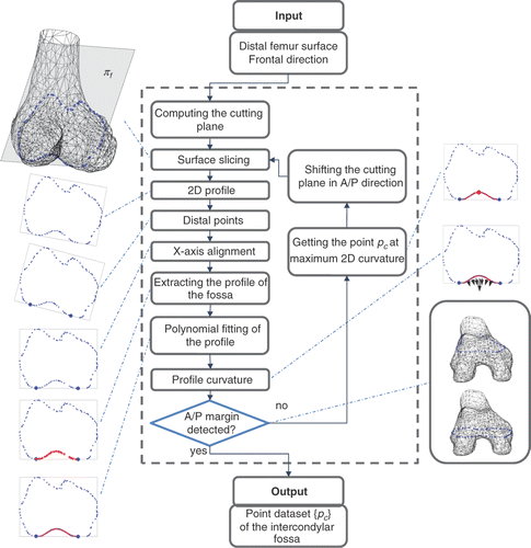 Figure 3. Processing of the intercondylar fossa surface. The frontal plane πf is iteratively shifted in the anterior and posterior direction to obtain the cross-sections of the femur surface. For each cross-section, the algorithm extracts the contour, determines the distal points in the lateral and medial condyles, aligns the 2D profile along the X-axis, separates the 2D profile of the fossa from the overall profile, computes the fifth-order polynomial fitting of the profile, and finally determines the point pc corresponding to the maximum curvature. The anterior margin is automatically detected by using a lower threshold for the maximum curvature of the profile (10% with respect to the maximum curvature measured on the central profiles) as the fossa becomes progressively smoother in the anterior direction. The posterior margin is detected by using a lower threshold (1 mm) on the RMS residual of the polynomial fitting with respect to the profile points. The collected point set {pc} is then used for 3D fitting the WL.