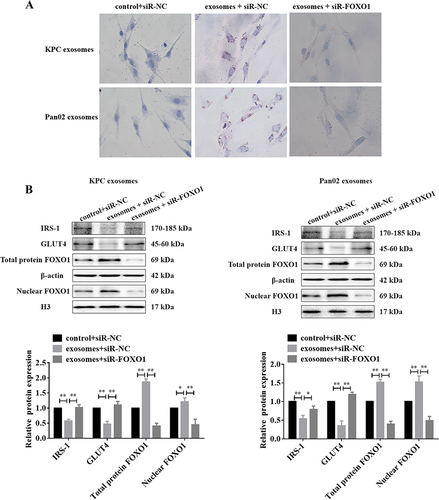 Figure 6 Knocking FOXO1 down reverses PC cell-derived exosome-induced insulin resistance. (A) Oil Red O staining assay of lipid accumulation in C2C12 myotube cells treated with exosomes or co-silenced FOXO1, the red part indicates the stained lipid particles. (B) Western blotting results of the expression of IRS-1, GLUT4, total protein FOXO1 and nuclear FOXO1; and the quantitative results of the immunoblots were shown in the histogram below. β-actin was used as a control of total protein. *P<0.05, **P<0.01.