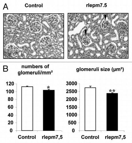 Figure 4 Effect of neonatal treatment on the histological structure of the kidney. (A) Representative kidney sections from control and leptin antagonist-treated rats. Arrows indicate fetal glomeruli. Bars = 100 µm. (B) Density and size of glomeruli in the renal cortex of control and leptin antagonist-treated animals. Values represent the mean ± SEM, n = 8 per group. *p < 0.05, **p < 0.01 between control and rlepm7.5 animals.