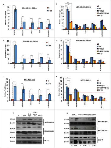 Figure 6. TAMs-assisted cancer cell invasion via MIP-1β is dependent on upregulation of MYO3A gene with in cancer cells. (A, B and C) Quantitative RT-PCR-based validation of selected genes (through c-DNA-based gene-expression analysis) in mono-cultured [C] and co-cultured (with macrophages) cancer cells [C+M]. Bars represent relative fold change in expression levels ±SE (*p < 0.05). (D, E and F) MYO3A gene exhibited a characteristic MIP-1β-responsive mRNA exprerssion profile. MIP-1β-neutralizing antibody (MIP-1β NA) treated cells showed decrease in MYO3A expression compared to cells that were co-cultured with macrophages [C+M] and/or IgG antibody control [C + M + IgG]. MIP-1β-purified cytokine (MIP-1β) enhanced the expression of MYO3A gene in monocultured cancer cells compared to cells that were not treated with MIP-1β-purified cytokine (C). Bars represent Quantitative RT-PCR relative fold change expression ±SE (*p <0.05.). All the experiments were done in triplicates and repeated at least thrice. (G and H) Blockade of MIP-1β with MIP-1β-neutralizing antibody (MIP-1β NA, Fig. 6G) and its cognate receptor CCR4 and CCR5 silencing (CCR4-siRNA and CCR5-siRNA, Fig. 6H)) downregulated expression levels of MYO3A in breast cancer cells (MDA-MB-231, MDA-MB-468 and MCF-7). MIP-1β-purified cytokine (MIP-1β) enhanced the expression of MYO3A gene in monocultured cancer cells compared to cells that were not treated with MIP-1β-purified cytokine (C) Fig. 6G. All the experiments were done in triplicates and repeated at least thrice. Abbreviations—C: Respective cancer cells; C + M: Respective cancer cells co-cultured with macrophages; C+M(IgG): Respective cancer cells co-cultured with macrophages treated with isotype antibody control IgG; C + M + MIP-1β NA: Respective cancer cells co-cultured with macrophages treated with MIP-1β-neutralizing antibody; MIP-1β: Respective cancer cells treated with MIP-1β-purified cytokine.