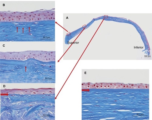 Figure 6 Masson’s trichrome staining of the Bowman’s layer.