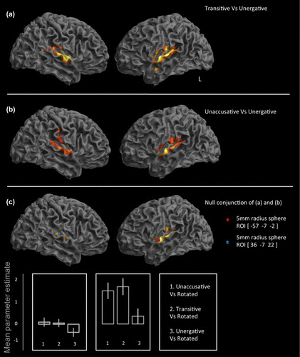 Figure 3. Perception of sentences with unaccusative and transitive verbs is associated with activity in similar areas, compared to perception of sentences with unergative verbs.For the comparison of sentences with transitive and unaccusative verbs, mean parameter estimates were extracted from spherical regions of interest of 5-mm radius, taken from peak coordinates from the null conjunction of (unaccusative vs. unergative) and (transitive vs. unergatives). The null conjunction revealed peak coordinates in superior temporal gyri in both hemispheres (p < 0.005 uncorrected) shown in (c). The lines denote the cortical activations during perception of unaccusative vs. unergative and transitive vs. unergative. Both peaks lay in superior mid-temporal gyri. Parameter estimates for three contrasts are plotted for both of these region of interest (ROI)s. In both regions there was greater activity during perception of unaccusative and transitive sentences.