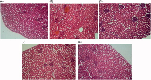 Image 2. Renal tissue sections of control rats (A), diabetic rats (B), diabetic rats treated with 75 mg/kg of S. bachtiarica extract (C), diabetic rats treated with 150 mg/kg of S. bachtiarica extract (D) and diabetic rats treated with 250 mg/kg of S. bachtiarica extract (E); haematoxylin-eosin staining; magnification x40.