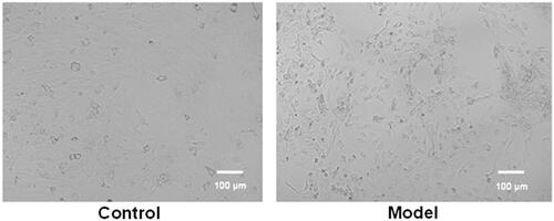 Figure 3. Typical images of epileptic model cells and control cells. The migration of neurons, the aggregation of cell bodies and the “grid-like” changes of neural networks were observed in the image of model cells.