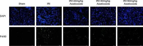 Figure 3. Asiaticoside reduced the infiltration of macrophages in renal IRI mice. The fluorescence intensity of F4/80 in Sham group, IRI group, IRI with a low dose group (20 mg/kg), a medium dose group (40 mg/kg) and a high dose group (60 mg/kg) groups.
