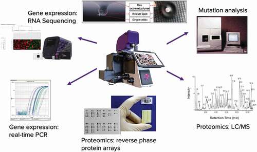 Figure 2. LCM technology uses laser cutting or laser induced surface capture (upper insert) to procure select tissue full thickness sample. The procured material is then extracted and subjected to a plurality of downstream analytical tools yielding discovery of spatially localized tissue molecules or multiplex quantitation of known analytes