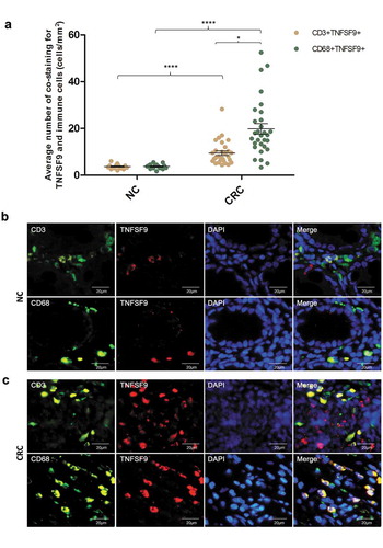 Figure 4. TNFSF9 was mainly derived from macrophages in the colorectal microenvironment. (a) The frequency of immunoﬂuorescence co-staining for immune cells (CD3+, CD68+) and TNFSF9 in CRC tissues (n = 30) was significantly higher when compared to normal colorectal tissues (n = 15) (P< .0001, P< .0001, respectively). In CRC tissue, the frequency of immunoﬂuorescence co-staining for macrophages (CD68+) and TNFSF9 was significantly higher when compared to that for CD3 + T cells and TNFSF9 (P< .05). (b, c) Representative images of co-staining for immune cells (CD3+, CD68+) and TNFSF9 in NC and CRC tissues. Magnification, 400×; scale bars, 20 μm. **** P <.0001, * P< .05, unpaired t-test. CRC, colorectal cancer; NC, normal colon.