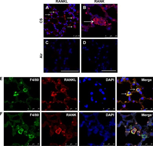 Figure 2 Expression and cellular localization of RANKL and RANK in CS-exposed mice.