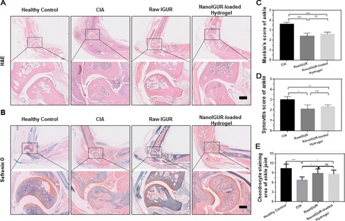 Figure 6 Results of histological evaluation. H&E staining (A); saffron O-fixing green staining (B); Mankin’s score of CIA rats (C); synovitis score of the CIA rats (D); percentage of cartilage area in each group (E); healthy control = healthy normal rats, CIA model = CIA rats with no intervention, raw IGUR= CIA rats treated with raw IGUR 10 mg/kg intragastrically, daily, NanoIGUR-loaded hydrogel= CIA rats treated with NanoIGUR-loaded hydrogel 10 mg/kg by subcutaneous injection, every 3 days. Data represent three independent experiments (mean ± SD), *p < 0.05, **p < 0.01, ***p < 0.001; ns, not significant; n = 7 per group, Scale bar = 200 μm.