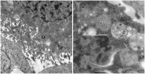 Figure 7. TEM images of the cellular uptake of UMCS.