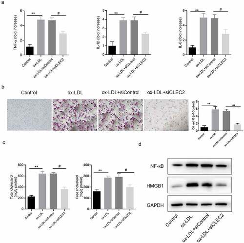 Figure 3. CLEC2 knockdown inhibited ox-LDL-induced inflammatory response and lipid accumulation in macrophages. (a) The levels of inflammatory cytokines were detected by ELISA. (b) Lipid accumulation was detected by oil red O staining, the area was measured by Image Pro Plus. (c) The contents of TC and FC were measured using colorimetric kits. (d) Western blotting was applied to detect the levels of protein expression. **P < 0.01 compared with control; #P < 0.05 compared with ox-LDL+siControl.