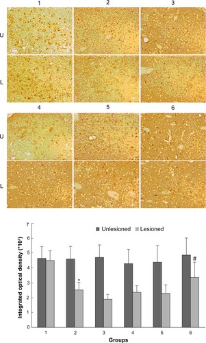 Figure 5 Effect of Tianqi antitremor granules on levels of β-arrestin1 in dyskinetic rats.
