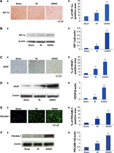 Figure 1 Photomicrographs of immunoreactivity (immunohistochemistry) and Western blots of HIF-1α, VEGF, and PECAM-1 in the cortical peri-infarct area at 14 days after IR.