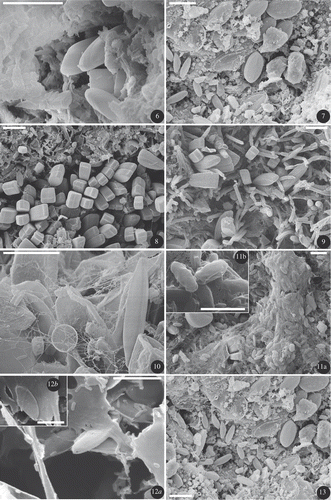 Figs 6–13. SEM photos of dehydrated biofilms, Fig. 6: site R (day 29), Gomphonema pumilum, attached with short stalks, always observed in depressions. Fig. 7: site #1 transferred in R (day 29), Achnanthidium biasolettianum and Cocconeis placentula var. euglypta, adnate attachment. Fig. 8: site #2 (day 0), colony of Gomphonema parvulum, attached with short stalks. Fig. 9: site #5 (day 0), Gomphonema parvulum attached with short stalks among filamentous bacteria. Fig. 10: site #3 (day 0), Nitzschia palea, non-attached, motile diatom with a small centric on the left. Figs 11a, b : site #3 (day 0), colony of the motile Fistulifera saprophila in a mucilaginous organic matrix. Figs 12a, b : site #4 (day 0), the motile Mayamaea atomus var. permitis in an organic matrix. Fig. 13: site #1 transferred in R (day 29), Achnanthidium minutissimum and Cocconeis placentula var. euglypta, with adnate attachment. Scale bars: 10 µm (Figs 6–10, 11a, 13); 5 µm (Figs 11b, 12a, 12b ).