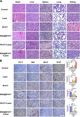 Figure 7 Histological analysis. (A) Representative histological features of the major organs of the tumor-bearing mice with various treatments. Scale bars, 50 μm (B) Ki-67, CC-3, Bax, and Bcl-2 immunohistochemical staining of tumor sections in the mice. Scale bars, 50 μm. Values represent the mean ± SD, n = 3. **p <0.01, ***p <0.001, ****p <0.0001.