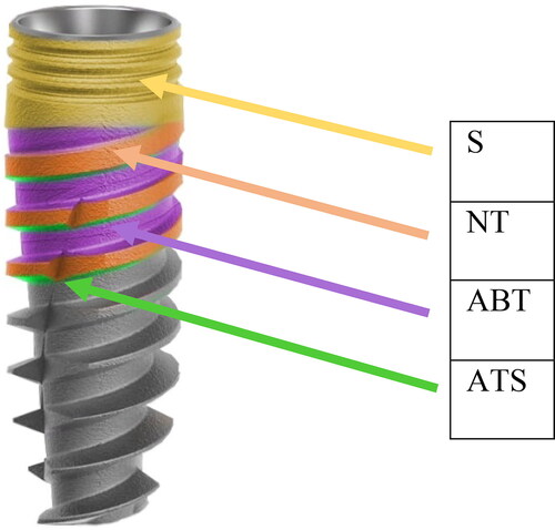 Figure 3. Implant surface locations (shoulder area (S), neck of threads (NT), area between threads (ABT), apically facing thread surface (ATS)).