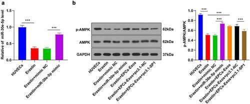 Figure 6. EPCs-Exos promoted the AMPK pathway activation through miR-30e-5p targeting SP1. In HUVECs treated with Erastin and transfected with miR-30e-5p mimic/NC, and HUVECs co-cultured with EPCs-Exos, treated with Erastin, and transfected with pcDNA3.1-SP1, the protein phosphorylation of the AMPK pathway was observed. A: The expression of miR-30e-5p was detected by RT-qPCR; B: The protein levels of p-AMPK and AMPK were detected by WB. The cell experiments were repeated 3 times independently. The data in the figure were all measurement data and were expressed as mean ± standard deviation. One-way ANOVA was used for data analysis. Tukey’s multiple comparisons test was used for the post hoc test. *** P < 0.001. pc3.1-NC was pcDNA3.1-NC, pc3.1-SP1 was pcDNA3.1-SP1.