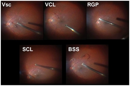 Figure 2 Representative fundus images through each material during core vitrectomy with a 128-degree objective lens.