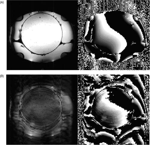 Figure 4. On the left side the magnitude images are seen for 0 and 900 W power, on the right side the attendant phase images (for PRFS thermometry method). The image interference looks as if the phantom is moving during measurement (which it cannot). The magnitude image shows a clear reduction of the signal, whereby the contours of the picture remain. In the phase image an expansion of phase signal into regions is seen, where no object is present and phase noise should normally be seen (see above the applicator in comparison to the admission without power). The temperature computation, according to the principle of difference to a reference image, is strongly reduced by these image artifacts.