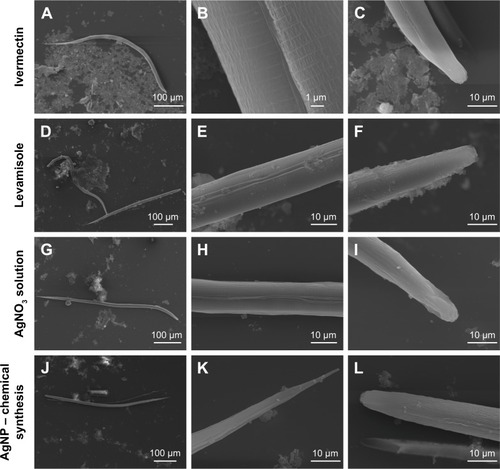 Figure 6 Images obtained by TEM of the larvae of Ancylostoma spp., treated with ivermectin (A–C), levamisole (D–F), AgNO3 solution (G–I), AgNP (chemical synthesis) (J–L), AgNP (Duddingtonia flagrans) 10.85 µg/mL (M–O), and AgNP (D. flagrans) 21.7 µg/mL (P–R). Amplification: 160× for D; 190× for J, P; 230× for G; 250× for A, M; 2,000× for R; 2,200× for E, H; 2,500× for C, F, I, K, L, N, O, Q; and 11,000× for B.Abbreviations: AgNPs, silver nanoparticles; TEM, transmission electronic microscopy.