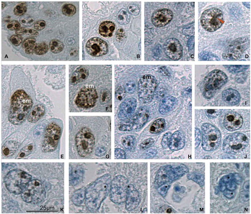 Figure 2. Immunolocalization of the Ki-67 protein in the trophoblast cells of the spongy zone of the silver fox at the 20th gd. (A) intensive Ki-67 immunostaining in the nuclei and karyoplasm of the low-ploid trophoblast cells close to the border with endometrium; (B–D) Ki-67 localization in the chromosome structures in the highly polyploid trophoblast cells; (C, D) Ki-67-positive chromatin strands (chromonemes) run from the nuclear envelope to nucleolus, as in Rabl orientation; the Ki-67-positive chromosome strands running in parallel into the nucleolus (arrowhead) prove some features of non-classic polytene chromosomes; (E–G) endomitotic (em) chromosomes show intensive Ki-67 immunostaining; (H–J) attenuation of Ki-67 immunolabeling in the region of trophoblast cell detachment from trabeculae: nucleoli longer retain the Ki-67 immunostaining, meanwhile endomitotic chromosomes often retain Ki-67 immunostaining longer than disappearing nucleoli; (K–N) subdivision of highly polyploid nucleoli into two or more ones via nuclear fragmentation (*); nucleoli and chromatin lose Ki-67 immunostaining. Magnification (Figure 2(k)) is the same for all photos.