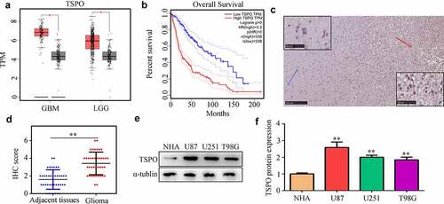 Figure 1. TSPO expression was increased in glioma. (a) Expression of TSPO in glioma and adjacent normal tissues in TCGA database. (b) Increased expression of TSPO in glioma tissues predicted poor outcome in TCGA database. (c-d) Expression of TSPO in glioma and adjacent tissues from our research cohort. (e-f) Protein expression level of TSPO in NHA, U251, U87, and T98G cells. ** P < 0.01.