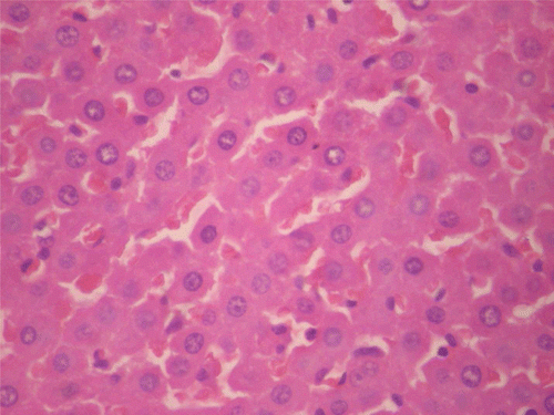 Figure 11.  Histopathologic presentation of male rat liver of CF 1000 mg/kg group, reversibility study (Congested; 400×).