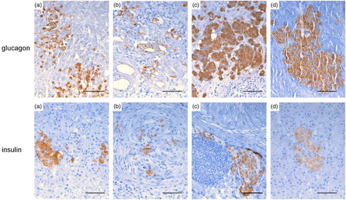 Figure 3. Turkey, pancreas, glucagon, and insulin IHC expression at different infection phases with AIVs Glucagon and insulin expression, shown during the early (a), intermediate (b), late phases (c), and control (d) phases, were preserved throughout the post-infection course in nearly all turkeys, although positive areas were less numerous and smaller in the early and intermediate phases and larger in the last. Some positive cells were also evident within ductular cells (b). (glucagon: A case no. 1, B case no. 20, C case no. 26, D case no. 30; insulin: A case no. 1, B case no. 20, C case no. 27, D case no. 30. Glucagon and insulin IHC, DAB chromogen, Haematoxylin counterstain) bar = 50 µm.