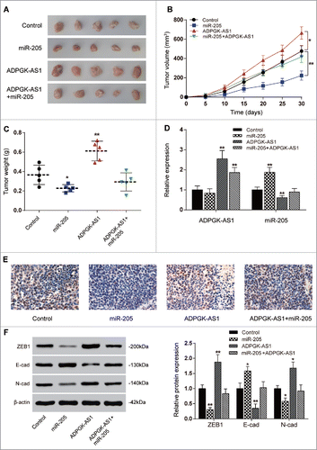 Figure 6. ADPGK-AS1/miR-205-5P regulated PC tumor growth through EMT in vivo (A) Images of the excised tumors at 30th day were presented; (B) Tumor volume of miR-205-5p group was significantly lower while which of ADPGK-AS1 group was significantly higher; (C) Tumor weight of miR-205-5p group was significantly lower while which of ADPGK-AS1 group was significantly higher; (D) Total RNA in tumor tissues was extracted and qRT-PCR was utilized to measure the expression of ADPGK-AS1 and miR-205-5p. (E) Immunohistochemistry staining of Ki-67 was performed to value the cell viability during tumorigenesis. (F) Western blot: In tumor tissues, E-cadherin expression was promoted by miR-205-5p while suppressed by ADPGK-AS1; ZEB1 and N-cadherin expressions were suppressed by miR-205-5p while promoted by ADPGK-AS1. (*P < 0.05, **P < 0.01, compared with control group).