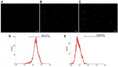 Figure 3 (A) The DiI-labelled NPs emitted red fluorescence. (B) FITC-labelled secondary antibody emitted green fluorescence after combination with NPs. (C) Both showed Orange fluorescence under the fusion channel. (D) Connection rate of the GSN monoclonal antibody on GSN-PLGA-PFH-DOX NPs. (E) Connection rate of the control group (Scale bar: 5 μm).