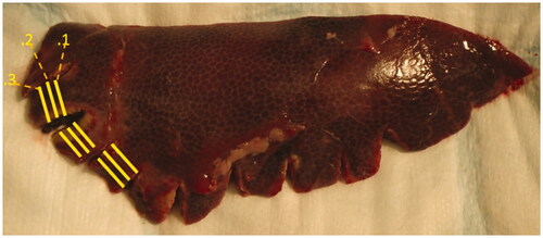 Figure 5. Histopathologic specimen immediately after section, with visualized liver bands cut perpendicular to the lower edge of the liver specimen. Yellow lines represent section for histopathological analyses at discrete distances from the lower edge of the liver. Each segment was further cut into 3 parallel slices and stained with haematoxylin-eosin.
