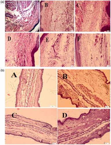 Figure 4. (a) Histological changes in rat paws after sub-plantar injection of carrageenan. (A) Normal paw. (B) Carrageenan-induced edema, and infiltration of leukocytes especially neutrophil. (C) Indomethacin (10 mg/kg, oral.) decreased paw swelling and infiltration of neutrophil. Oral pretreatment of rats with Nasturtium officinale at 250 (D), 500 (E) and 750 (F) mg/kg doses inhibited development of edema and migration of neutrophils, compared with carrageenan-treated paw. (b) Pathological examination of ear tissues after topical application of TPA. (A) Normal ear, (B) Control: Topical application of TPA (2.5 mg/ear) induced inflammatory lesion with edema and epidermal hyperplasia. (C) Topical application of the extract from the aerial parts of Nasturtium officinale (5 mg/ear) immediately after TPA reduced edema and epidermal hyperplasia induced by TPA. (D) Indomethacin (0.5 mg/ear) also decreased edema and ear hyperplasia. Sections were stained with hematoxyline and eosin, magnification ×20.