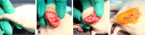 Figure 1 Treatment of the SD rats.Notes: (A) Select the surgical site. (B) Expose the surgical site. (C) Drill the hole and insert with or without nano-scaffold. (D) Close the surgical site.Abbreviation: SD, Sprague Dawley.